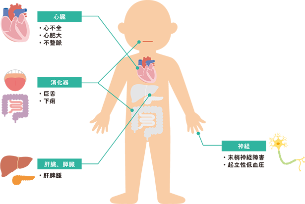 図2 各臓器におけるアミロイドーシスによる症状