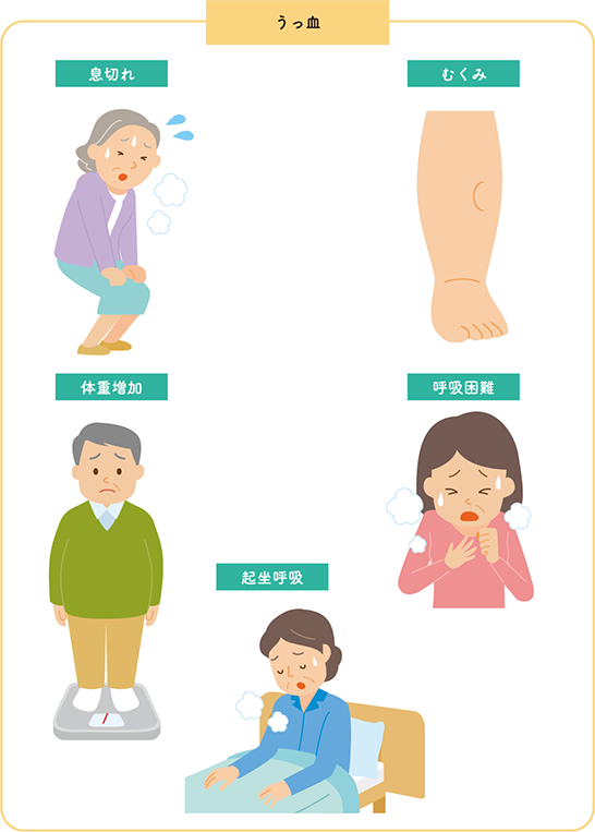 図4 うっ血による症状