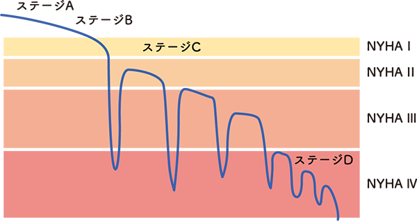 図6 心不全の進行